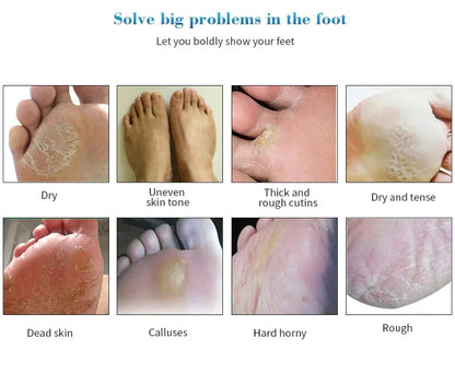 Exfoliating Foot Mask Foot SPA Pedicure Socks Removing Dead Skin Whitening Heels Feet Peeling Anti Cracked Foot Skin Care