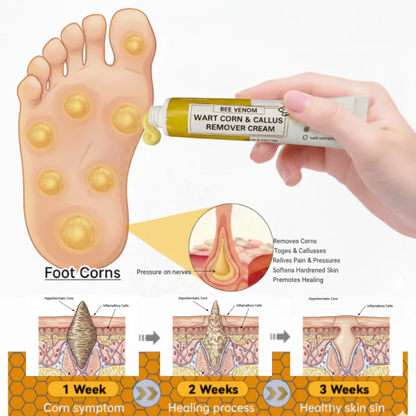 Bee Venom Corn & Callus Remover Cream
