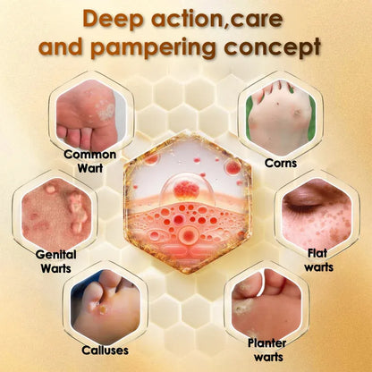 Bee Venom Corn & Callus Remover Cream
